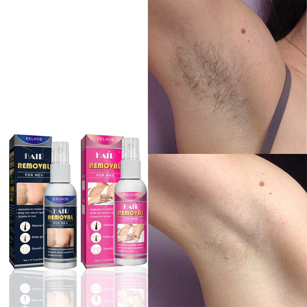 1/2 Buah Penghilang Rambut Per - Hair Care Lotion ulasan dan harga