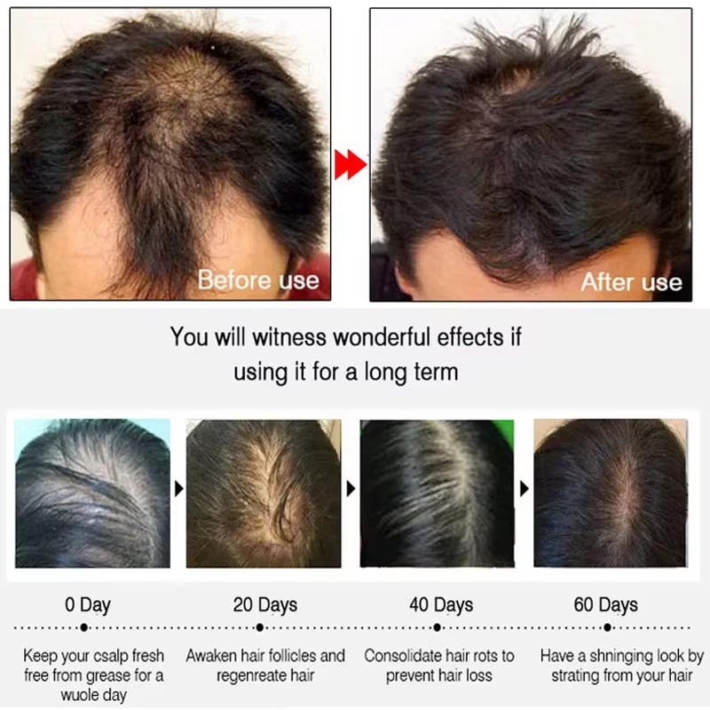 Semprotan Penumbuh Rambut Jahe - Hair Care Products ulasan dan harga